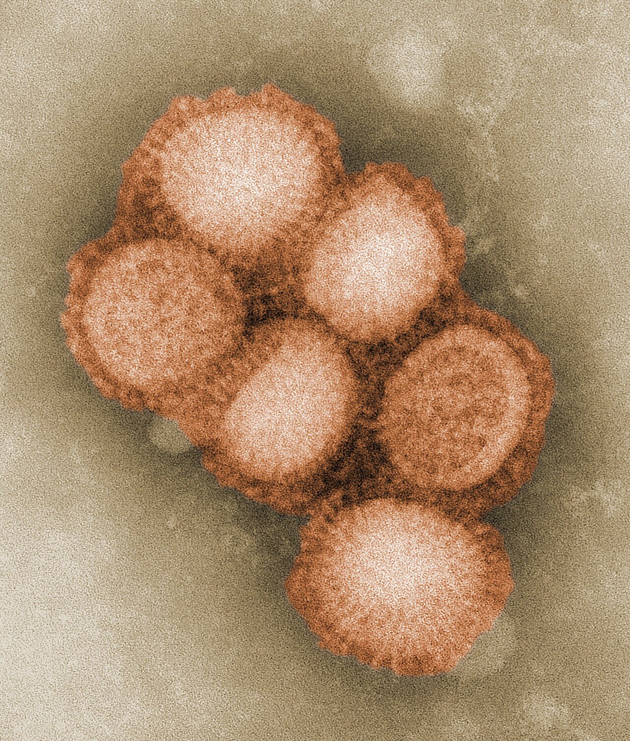 Transmission electron micrograph of 2009 H1N1 influenza virus particles