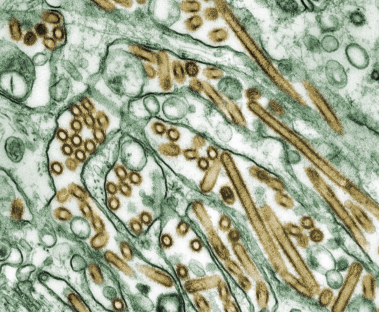 Colourised transmission electron micrograph of avian influenza A H5N1 virus particles