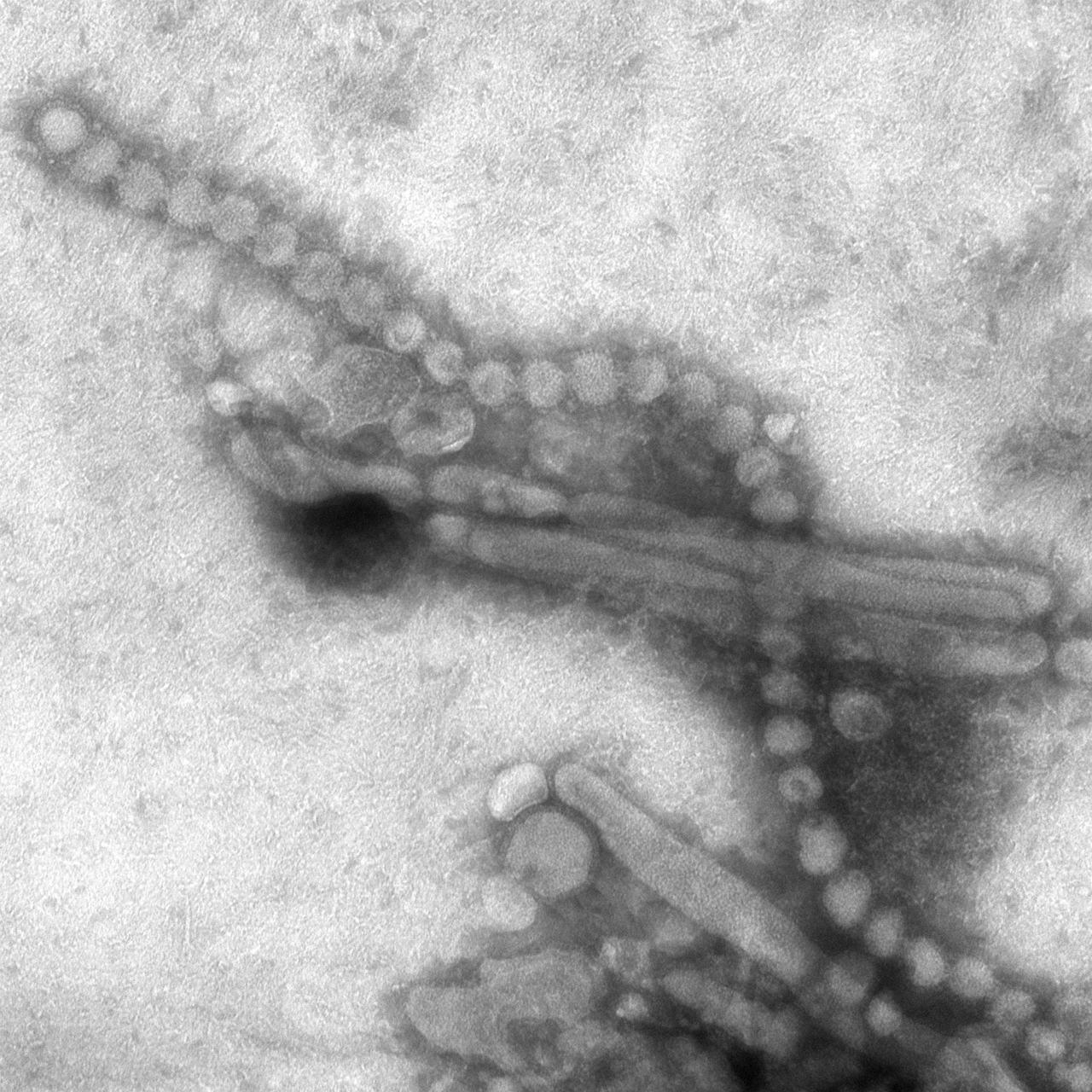 Transmission electron micrograph of influenza A H7N9 virus particles